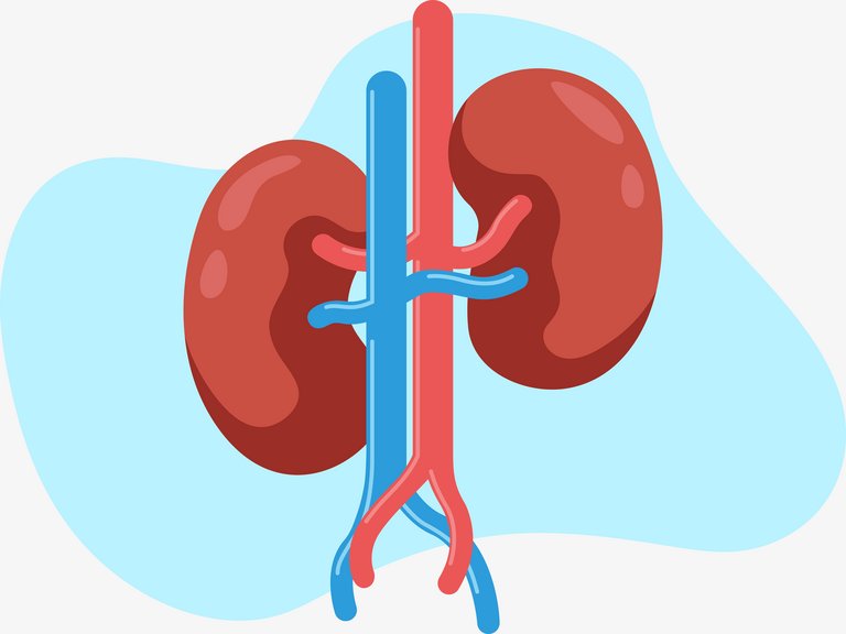 Kidney failure