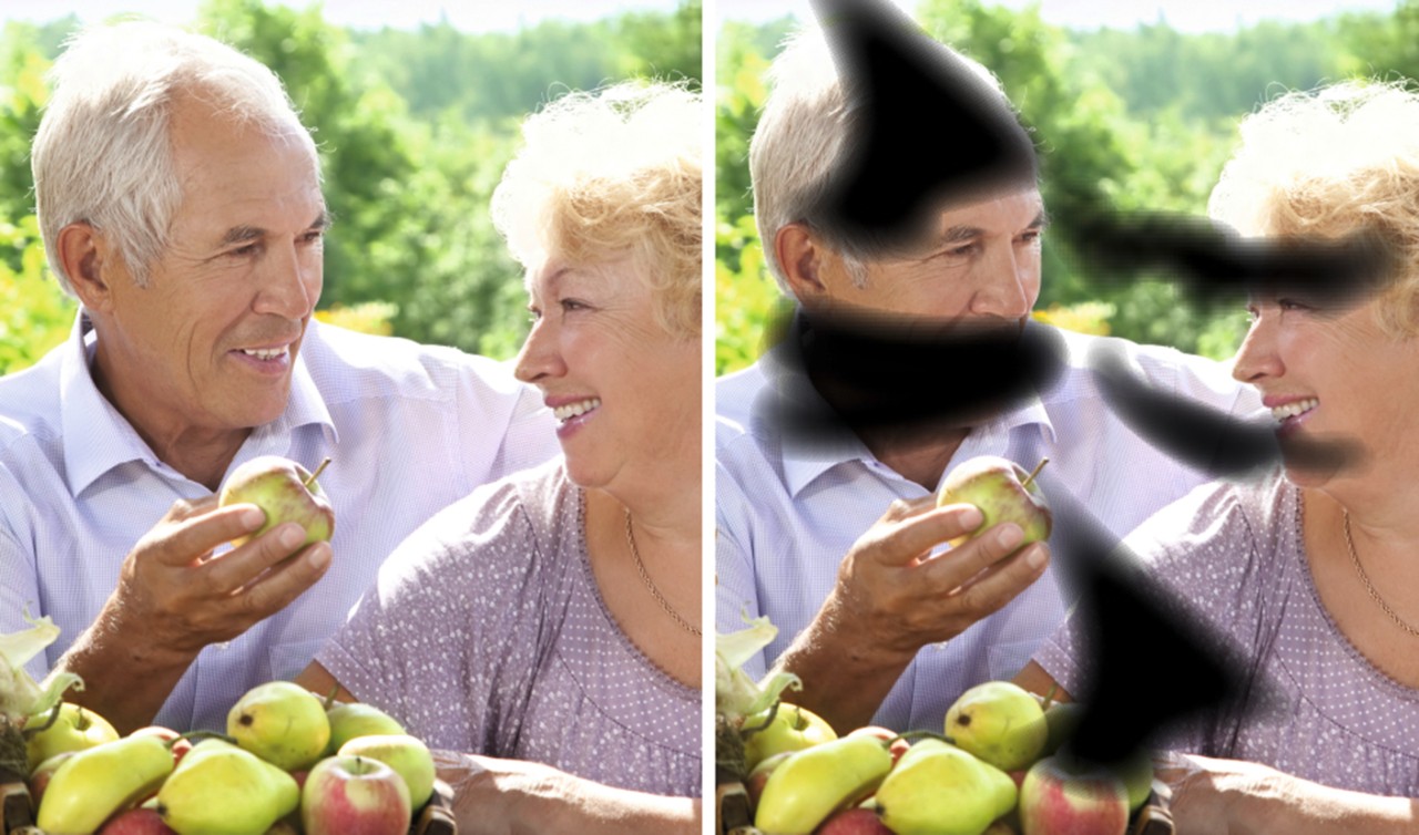 diabetic retinopathy