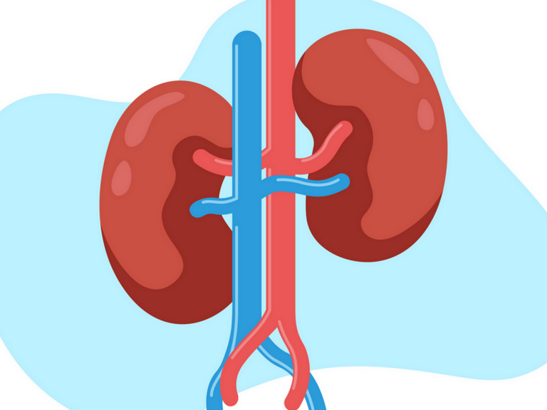 kidney transplant clipart